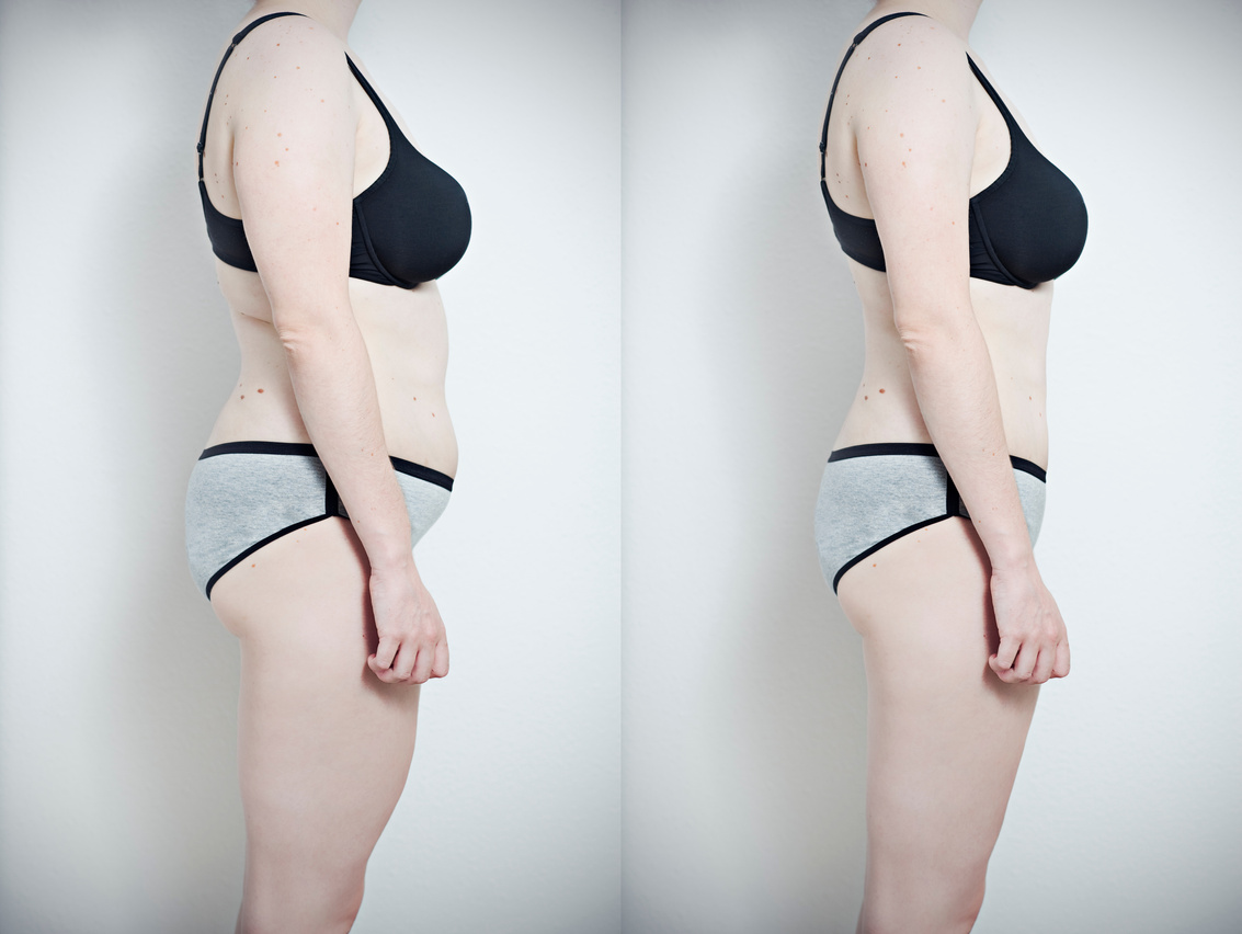 Before and after